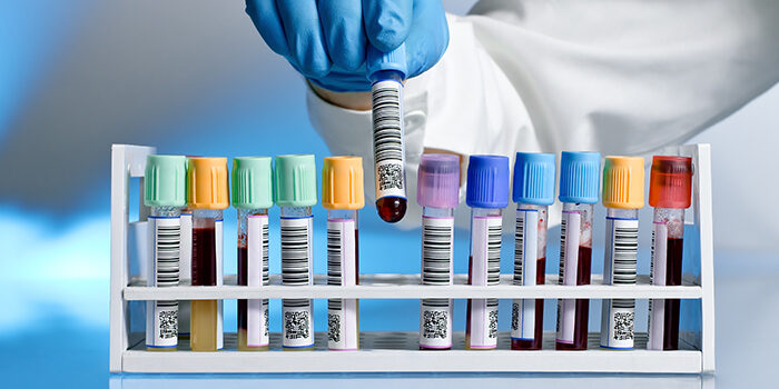 lab